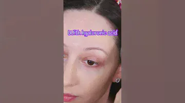 Why You Need This Foundation