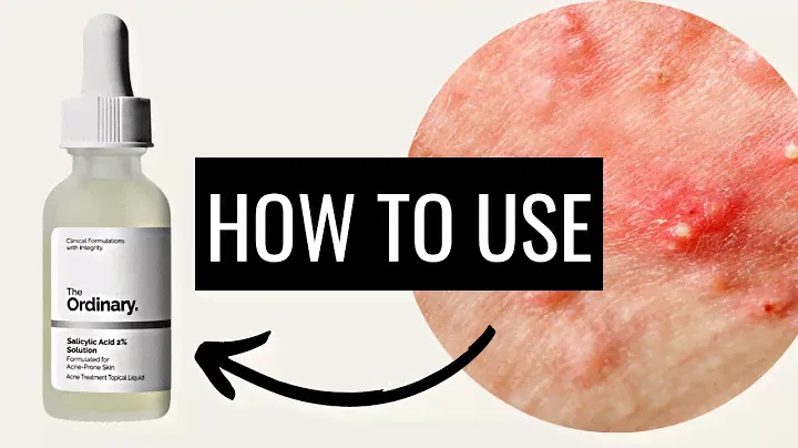 How To Use The Ordinary Salicylic Acid 2% Solution